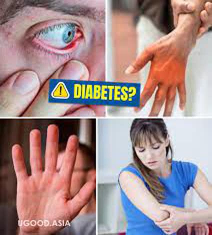 20 Signs of High Blood Sugar, iiQ8 health, Symptoms of Blood Sugar hyperglycemia